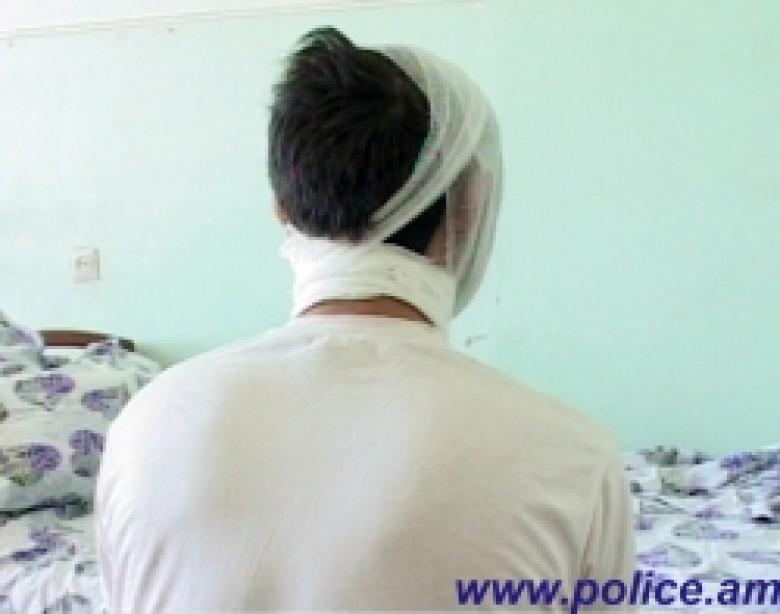 Պարանոցի կտրած վերքով հիվանդանոց էր տեղափոխվել 17-ամյա տղա (ՏԵՍԱՆՅՈՒԹ) Պարանոցի կտրած վերքով հիվանդանոց էր տեղափոխվել 17-ամյա տղա (ՏԵՍԱՆՅՈՒԹ)