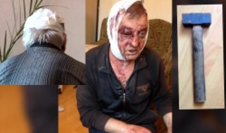 Ավազակային հարձակում՝ կալանավայրի «ուղեգիր» ստանալու ակնկալիքով (ՏԵՍԱՆՅՈՒԹ)  Ավազակային հարձակում՝ կալանավայրի «ուղեգիր» ստանալու ակնկալիքով (ՏԵՍԱՆՅՈՒԹ)