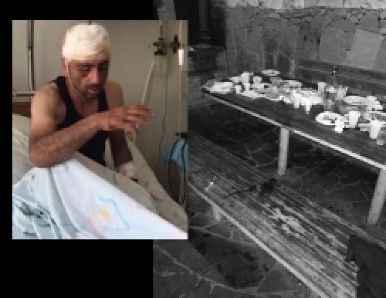 Դիլիջանում կատարված սպանությունը բացահայտվեց (ՏԵՍԱՆՅՈՒԹ)  Դիլիջանում կատարված սպանությունը բացահայտվեց (ՏԵՍԱՆՅՈՒԹ)