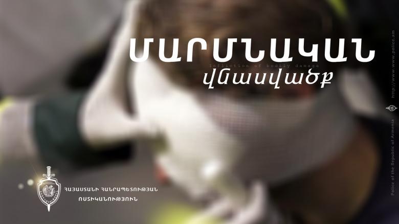 Կոստանտին Տեր-Նակալյանը վնասվածքներ է ստացել թաղեցու հետ վիճաբանության ընթացքում Կոստանտին Տեր-Նակալյանը վնասվածքներ է ստացել թաղեցու հետ վիճաբանության ընթացքում
