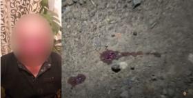 Դանակահարություն Դիլիջանի Անանյան փողոցում․ հանցագործությունը բացահայտվել է Դանակահարություն Դիլիջանի Անանյան փողոցում․ հանցագործությունը բացահայտվել է