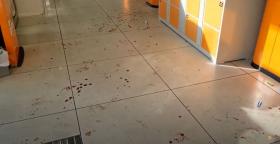 Սուպերմարկետի աշխատակցուհուն մարմնական վնասվածք հասցրած անձը ներկայացել է ոստիկանություն Սուպերմարկետի աշխատակցուհուն մարմնական վնասվածք հասցրած անձը ներկայացել է ոստիկանություն