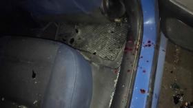 Խուլիգանություն, մարմնական վնասվածքներ և սառը զենքի հայտնաբերում. Արաբկիրի ոստիկանների բացահայտումը Խուլիգանություն, մարմնական վնասվածքներ և սառը զենքի հայտնաբերում. Արաբկիրի ոստիկանների բացահայտումը